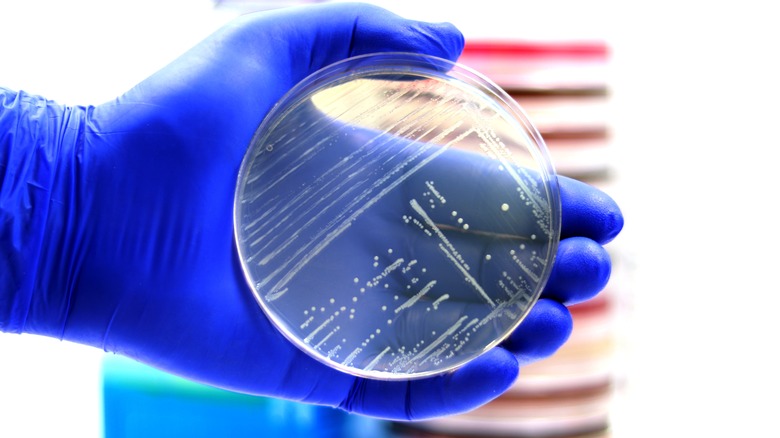 Gloved hand holding dish with listeria bacteria