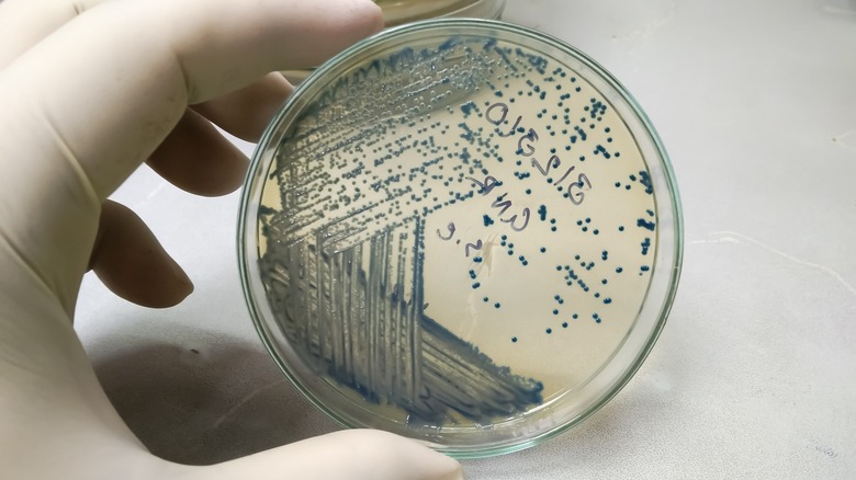 e. coli bacteria in a petri dish