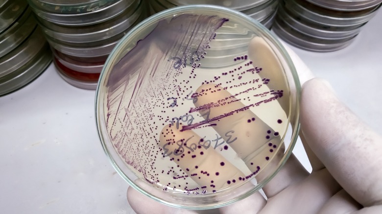 Gloved hand holding e. coli sample on transparent petri dish