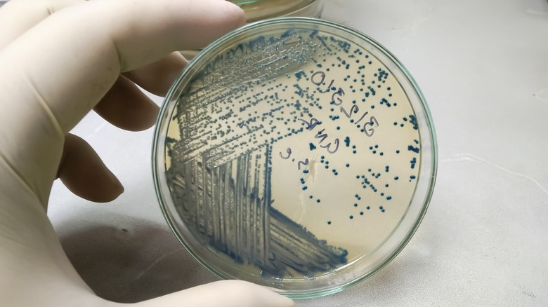 A strain of E. coli contained in a petri dish held by a gloved hand